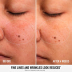 BARE MINERALS-Linha SKIN RESCUE PURE SMOOTH SERUM e soro corretor de rugas 30 ml-DrShampoo - Perfumaria e Cosmética