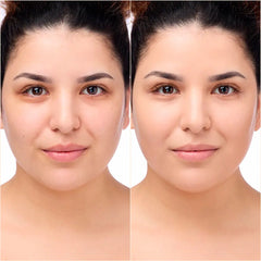 CATRICE-Soro corretor INSTANT BRIGHT 039W 5 ml.-DrShampoo - Perfumaria e Cosmética
