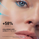 LABORATOIRES FILORGA-HYALU-FILLER serum 30 ml-DrShampoo - Perfumaria e Cosmética