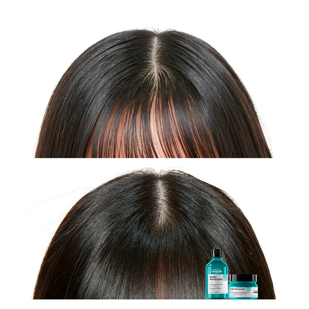 L'ORÉAL PROFESSIONNEL PARIS-MÁSCARA SHAMPOO PURIFICADOR PROFUNDO CLAY 2 em 1 SCALP ADVANCED 250 ml.-DrShampoo - Perfumaria e Cosmética