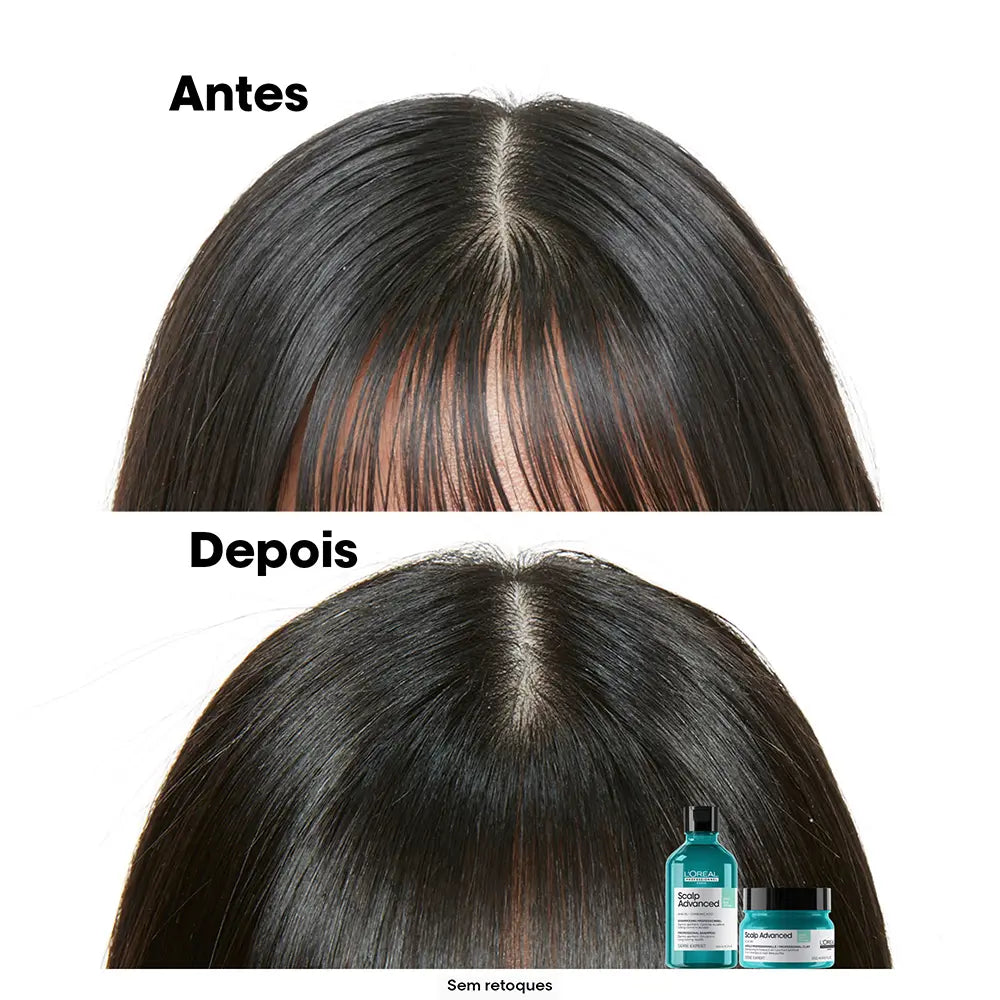 L'ORÉAL PROFESSIONNEL PARIS-SCALP ADVANCED champô 500 ml-DrShampoo - Perfumaria e Cosmética