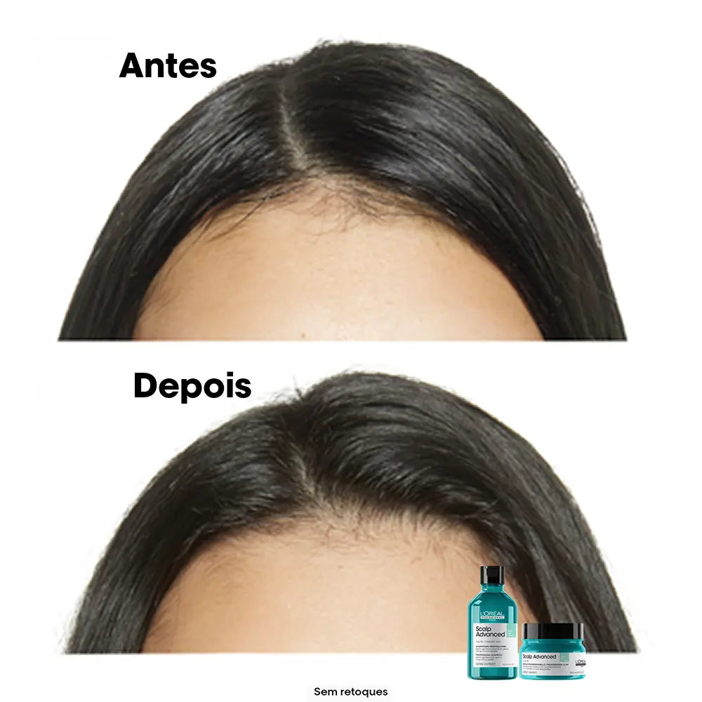 L'ORÉAL PROFESSIONNEL PARIS-SCALP ADVANCED champô 500 ml-DrShampoo - Perfumaria e Cosmética