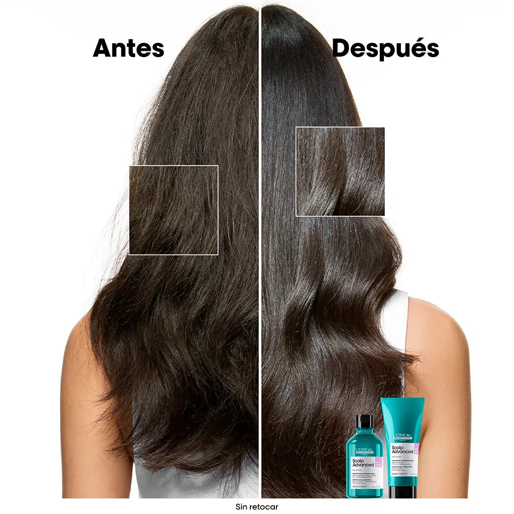 L'ORÉAL PROFESSIONNEL PARIS-Shampoo para couro cabeludo sensível SCALP ADVANCED refil 500 ml-DrShampoo - Perfumaria e Cosmética
