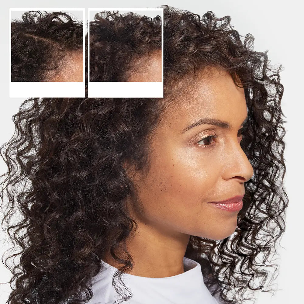 NIOXIN-SHAMPOO ANTI-QUEDA - Shampoo Queda de Cabelo 240 ml-DrShampoo - Perfumaria e Cosmética