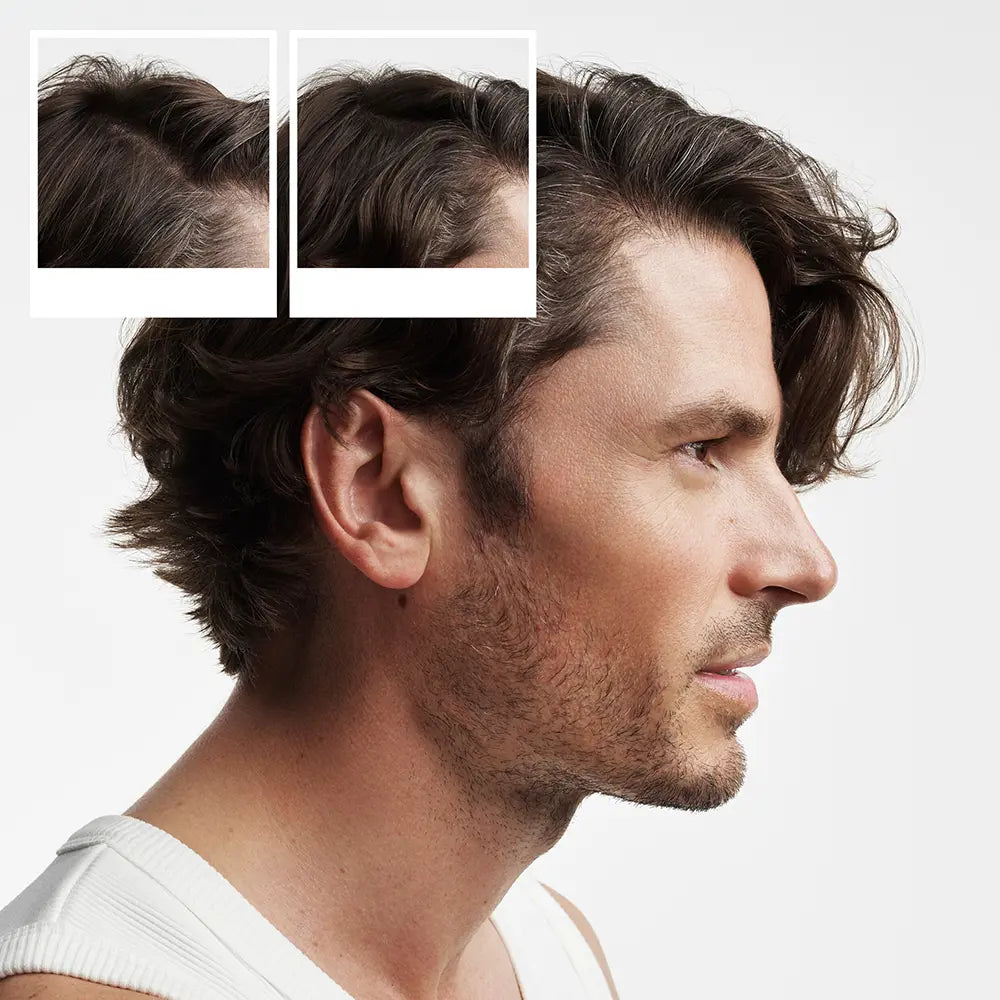 NIOXIN-SISTEMA 2 - Kit - Tratamento para Cabelos Naturais com Afinamento Avançado 3 unidades-DrShampoo - Perfumaria e Cosmética
